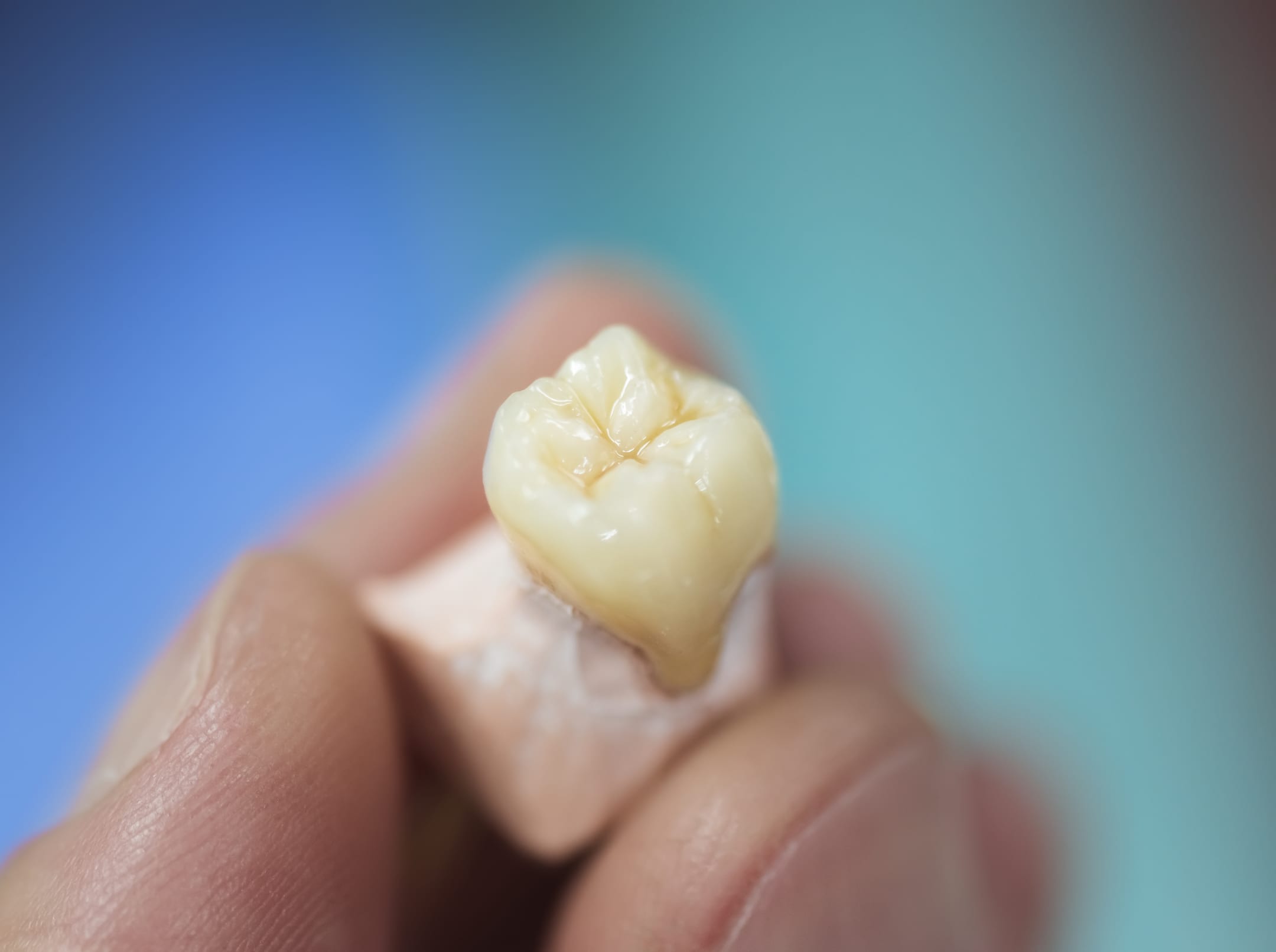 Porcelain Crowns versus Same-Day Crowns: Superior Craftsmanship or One-Day Convenience