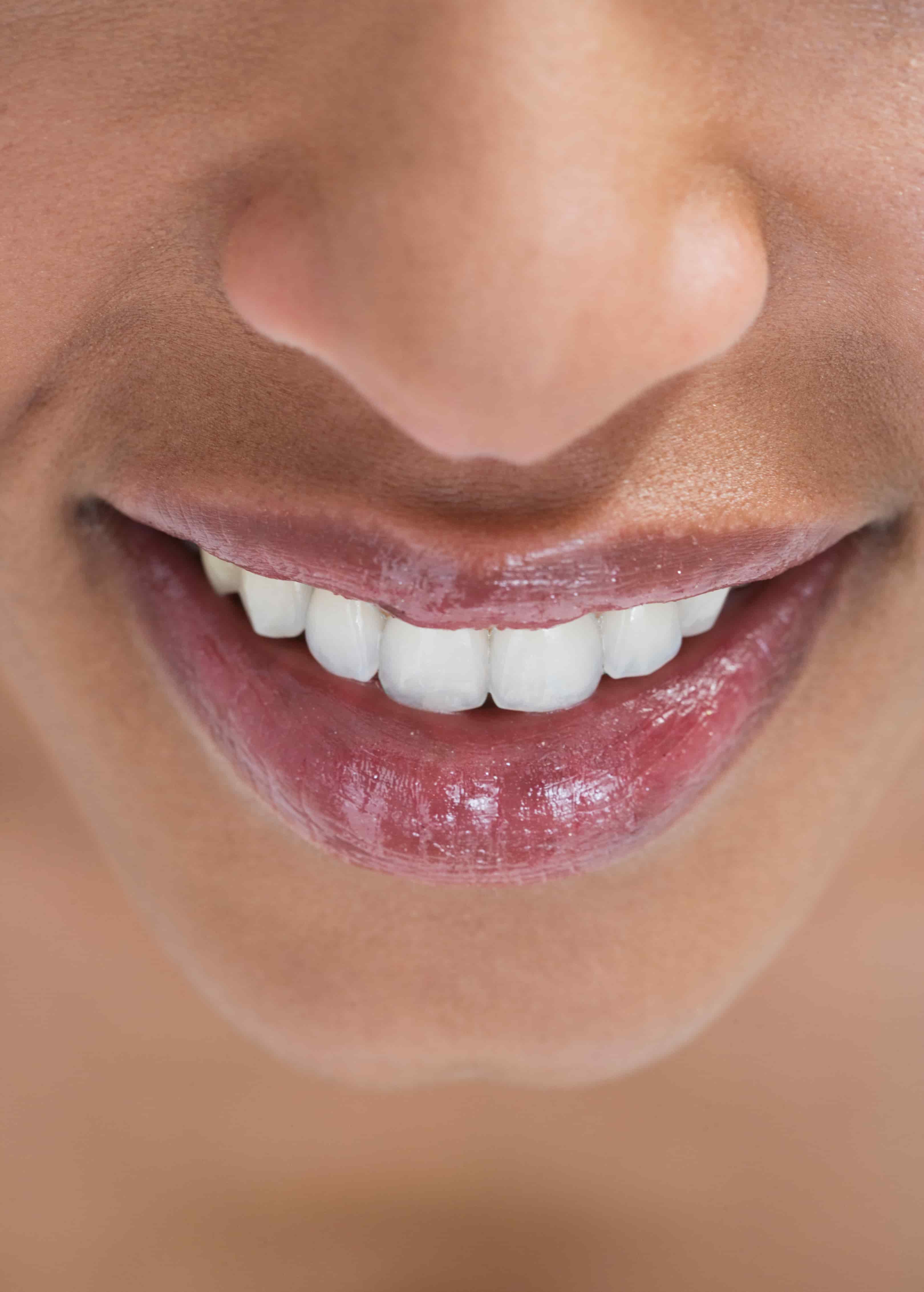 New Smile: 7 Easy Dental Resolutions